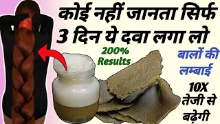 इस दवाई से बालों की लम्बाई 10 गुना तेजी से बढ़ेगी | 3 दिन लंबे मोटे होंगे बाल | Fast Hair Growth