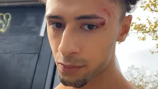 I FELL ON MY FACE TRYING TO BACKFLIP..