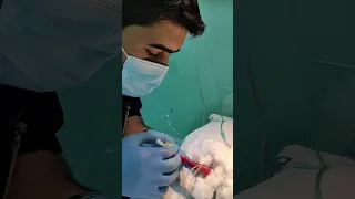 ولادة طفل خديج بوزن 450gm فقط 😳