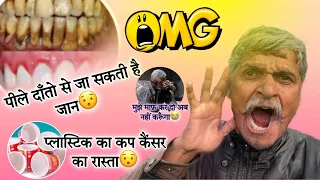 Plastik ka cup ☕️ | पीले दाँतो का राज😯 | #shortsvideo #health