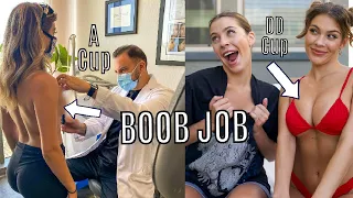 I GOT A BOOB JOB @ 20 YRS OLD.... EXPERIENCE, WHY, SIZE?