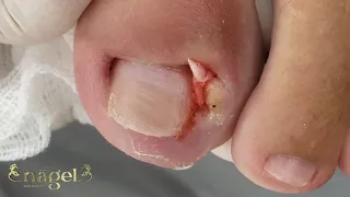 😱INACREDITÁVEL O QUE SAIU DALI #satisfying #viral