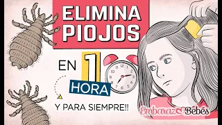 💇🏻‍♀️🔥 3 Remedios para ELIMINAR PIOJOS y Liendres en 1 HORA y para Siempre!!!