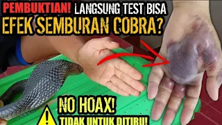 EFEK SEMBURAN BISA ULAR COBRA!! TEST BISA ULAR COBRA! BENARKAH BERBAHAYA JIKA MENEMPEL DI KULIT?