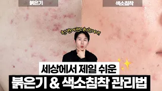 여드름의 흔적! 붉은기 & 색소침착 관리 이것만 딱 합시다!😎 세상에서 제일 쉬운 관리법 ep.3