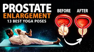 13 Best Yoga Exercises for Prostate Health | Natural Relief for Men #prostatecancer