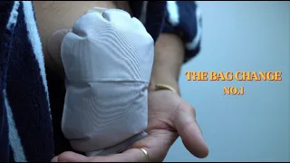 A detailed Ostomy/Stoma bag change..
