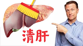 (肝臟) 保健肝臟、清肝最好食物,去除脂肪肝,柏格醫生 Dr Berg (211209)