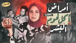 أمراض بسبب أكل لحوم البشر ! | أغرب كائن مسبب للأمراض في تاريخ الطب