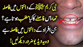 Meaning Of Gap Between Teeth Urdu Hindi - Prophet SAW K Dantoun Main Fasla Tha  || Urdu Lab