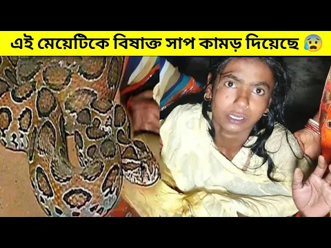 এই মেয়েটিকে একটা বিষাক্ত সাপ কামড় দিয়েছে 😰 #Facts_In_Bangla #shorts
