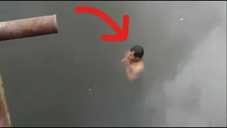 Something Really Bad Happened To This Man While Swimming In A River…