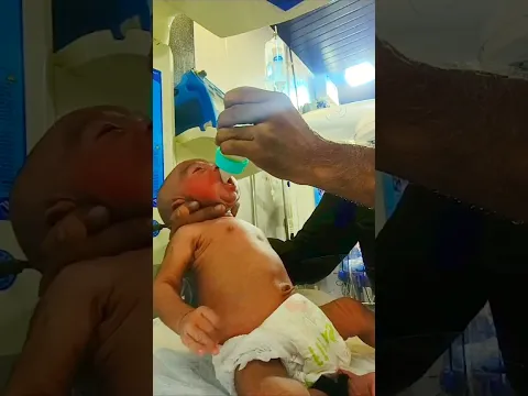 hunger baby #junior #babybirth #adorable #chubby ##cutebaby #newborn #feeding #shorts
