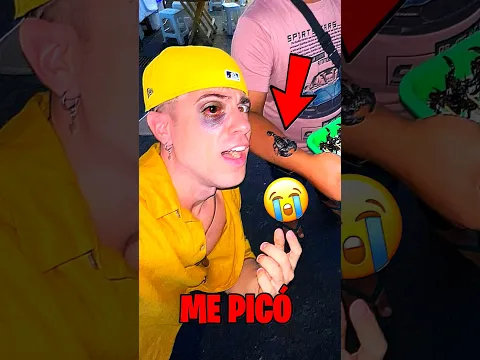 Alejo igoa casi SUFRE UN GRAVE ACCIDENTE 😱😧
