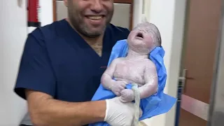 baby first cry change colour