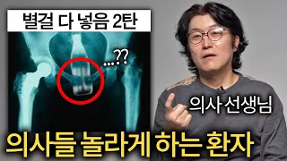 비뇨의학과 의사를 놀라게 만드는 환자들 (황금, 비타500 )
