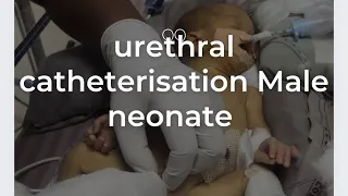Urethral catheterisation male neonate baby @Newborncarejammu