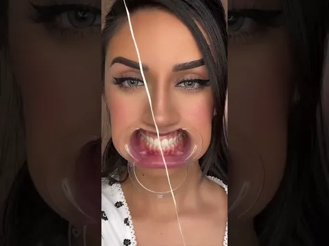 Teeth asmr 🦷💧