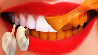सिर्फ 2 मिनटों में पीले गंदे दांतों को मोती की तरह चमका देगा ये नुस्खा | White Teeth Home Remedy