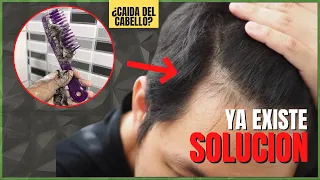Como Evitar La Caida Del Cabello | TOP 7 Metodos Comprobados Para Crecer El Cabello