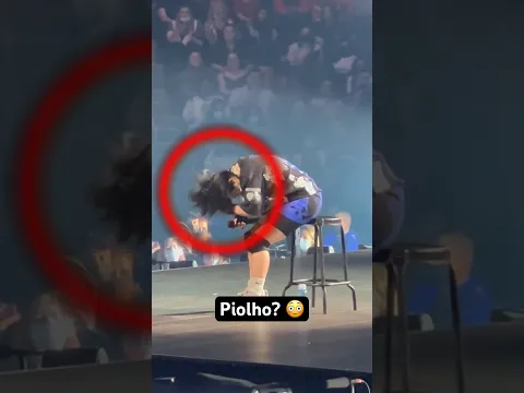 Billie Eilish PERIGO de piolho..