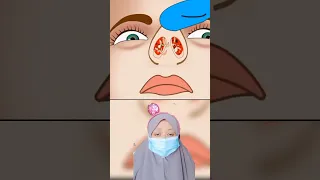 ASMR Luka Hidung Karena di Masukin cicak 😱 |Mv #shorts #gaming #asmr #animation
