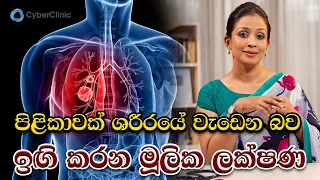 පිළිකාවක් ශරීරයේ වැඩෙන බවට ඉඟි කරන මූලික ලක්ෂණ |Dr.DR