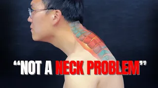 How to Fix Forward Head Posture & Neck Hump at Home