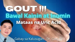 GOUT: Bawal Kainin at Inumin - Dr. Gary Sy