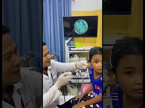 Deep Earwax Pulled Out in One Go! 😳👂 #EarwaxRemoval #DoctorShorts