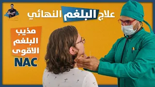 افضل علاج لطرد البلغم سريعا  من الصدر والحلق بطرق طبيعية/ افضل مذيب بلغم