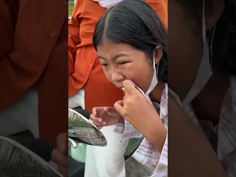 BERANI CABUT GIGI SENDIRI 🤣