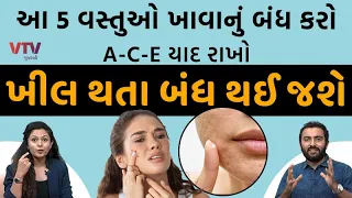 આ 5 વસ્તુઓ ખાવાનું બંધ કરો, A-C-E યાદ રાખો ખીલ થતા બંધ થઈ જશે | Ek Vaat Kau