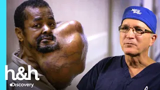 Médicos remueven inmenso bulto en su cuello | Mi cuerpo, mi desafío | Discovery H&H