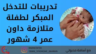 تدريبات للتدخل المبكر لطفلة متلازمة داون عمر 4 شهور مع سلسلة  من الارشادات الهامة | مع اسامة مدبولي