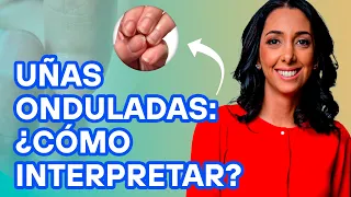 Uñas onduladas: ¿cómo interpretar?