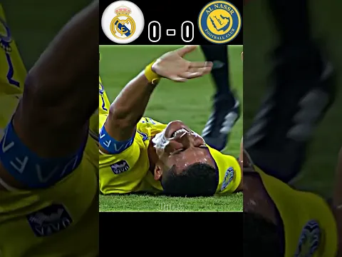 Real Madrid vs Al Nassar Ronaldo Injury 🤕
