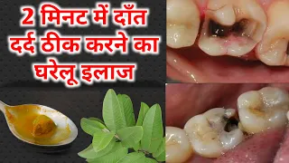 2 मिनट में दांत का कीड़ा और दर्द बाहर निकालने का अचूक घरेलु उपाय | Get rid of Tooth Cavity