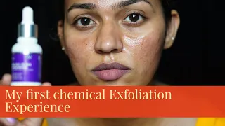 ഞാൻ പൊള്ളി പോയി എന്ന് വിചാരിച്ചു! My First Chemical Peeling Exfoliation