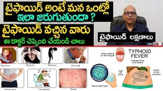Typhoid Fever Symptoms , Cause, Treatment, Tests, Diet | Doctors Advice |  Eagle Media Works