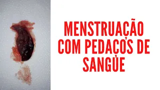 Menstruação com pedaços de sangue, é normal?