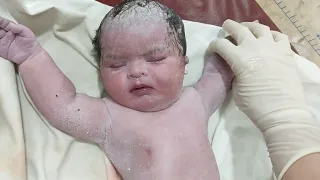 Special Down Syndrome Newborn baby is Biggest Blessing for Parents 💗 #viral