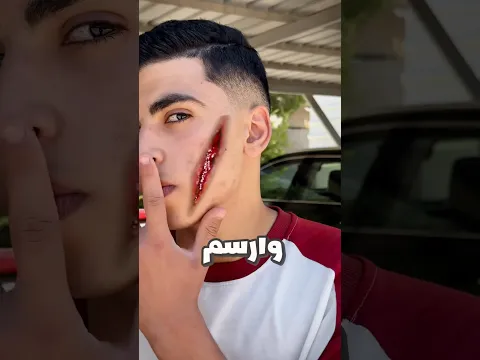 رسمت جرح على وجهي وفتت على المستشفى😱 #drawing #رسم #funny
