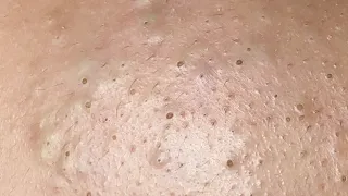 Satisfying Relaxing with Sac Dep Spa #423
