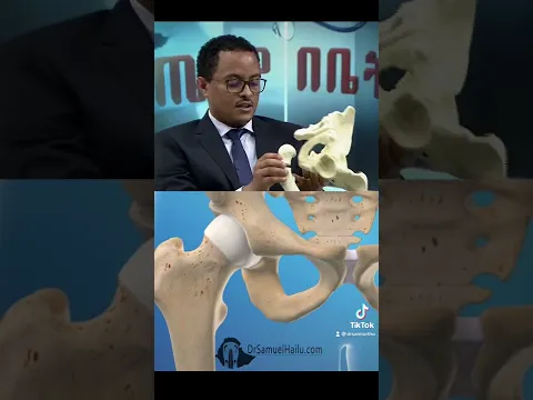 ዳሌ በአጥንት ህክምና