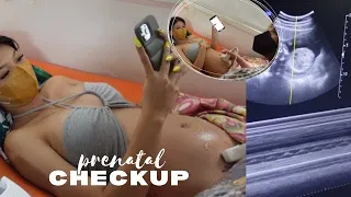 MY PRENATAL CHECKUP 🤰🤍/ THE DOCTOR KNOWS THE GENDER ALREADY 😱 #pregnancy
