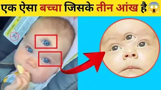 Doctor सफेद कोट क्यू पहनते है 😱 Most amazing facts | Amazing factz