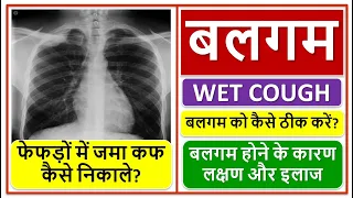 बलगम होने के कारण लक्षण और इलाज, फेफड़ों में जमा कफ कैसे निकाले?, बलगम को कैसे ठीक करें? WET COUGH,