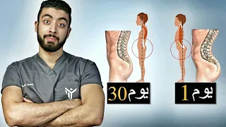 5 دقائق فقط وتخلص من بروز المؤخرة وتقوس أسفل الظهر فى 30 يوم | الأسباب وتمارين العلاج👌💪