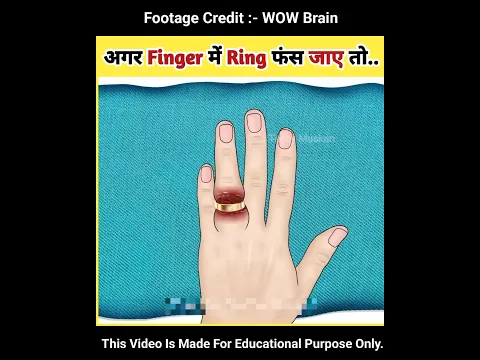 अगर Finger में Ring फंस जाए तो.. #asmr #shortsvideo